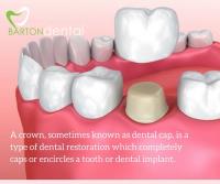 Barton Dental image 2